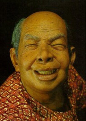 หัวล้านแบบดงช้างข้าม